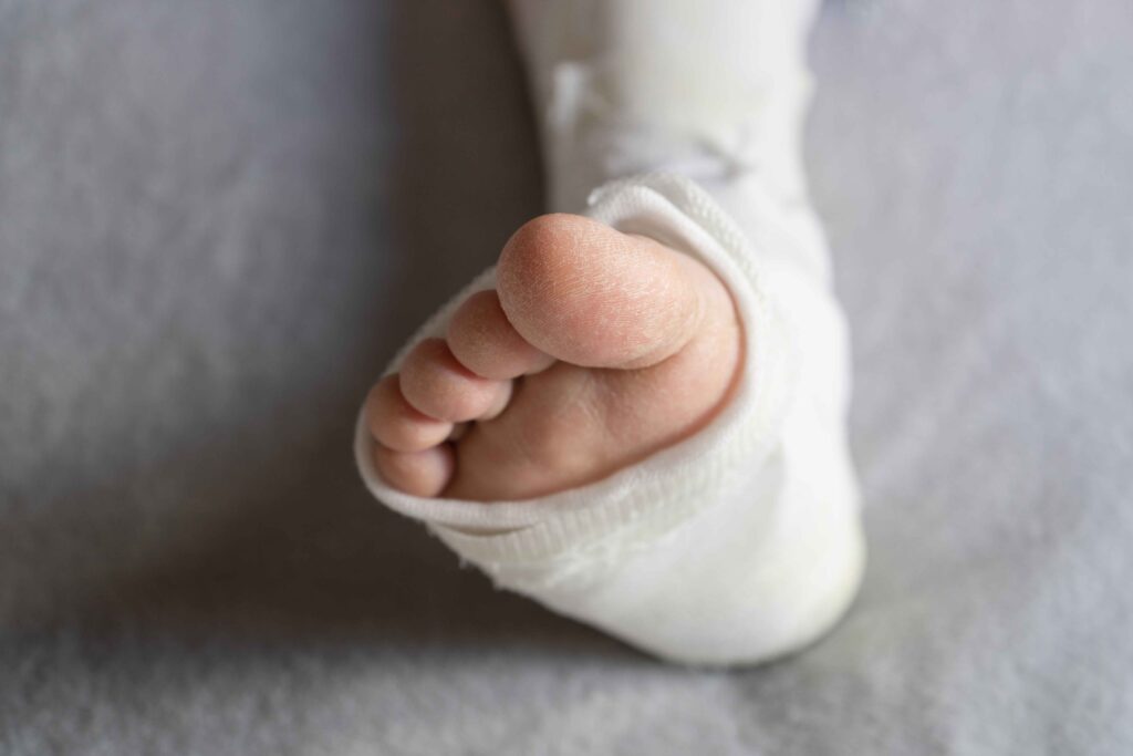 : surgical repair or reconstruction of a torn or degenerated achilles tendon.