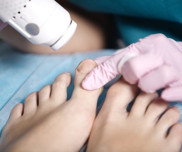 Antifungal Treatment