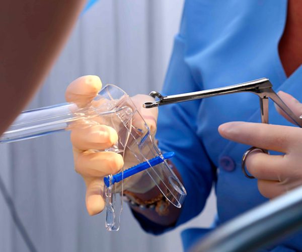 A cervical biopsy is a procedure in which a small sample of tissue is taken from the cervix—the lower part of the uterus—to examine for abnormal or precancerous cells.