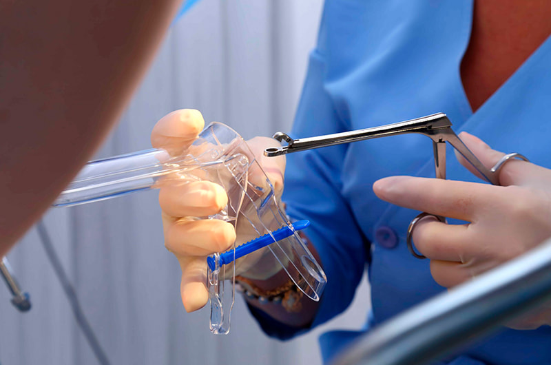 Cervical biopsy 3 A cervical biopsy is a procedure in which a small sample of tissue is taken from the cervix—the lower part of the uterus—to examine for abnormal or precancerous cells.