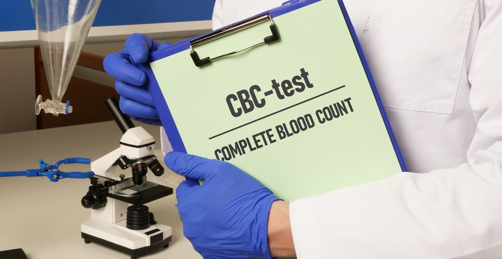 Complete blood count (cbc) 