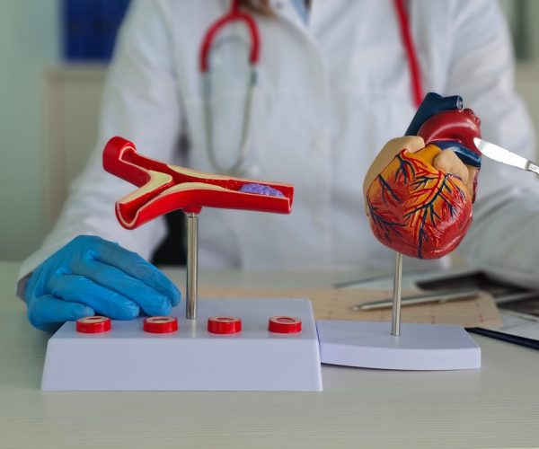 Coronary Artery Bypass Grafting (CABG) Coronary Artery Bypass Grafting (CABG)