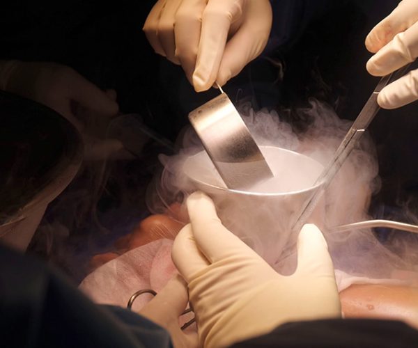 Cryosurgery Cryosurgery