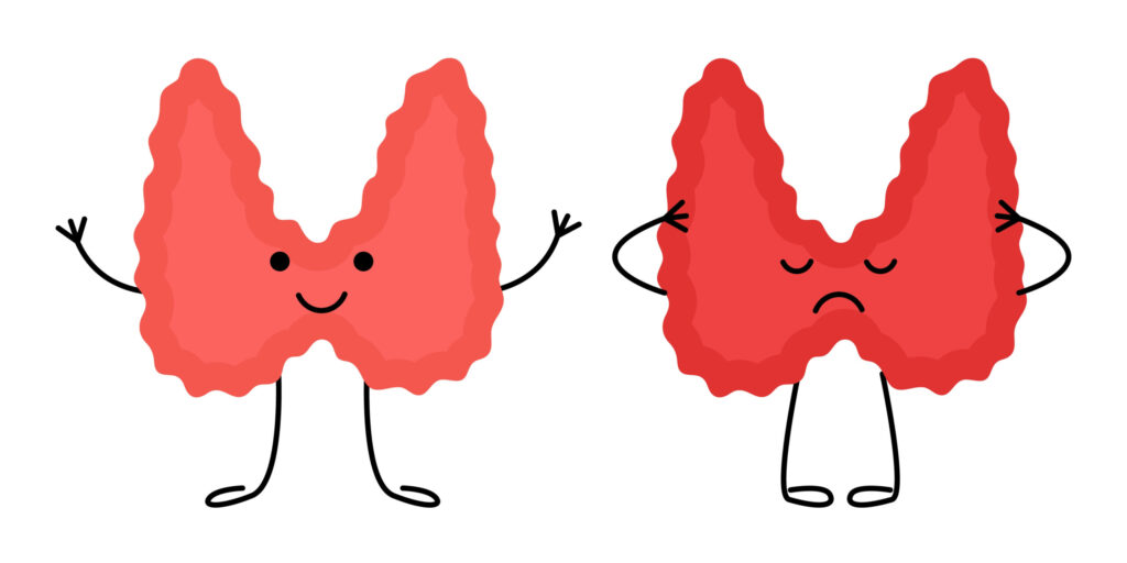 Discover how thyroid disorders like hypo‑ and hyperthyroidism can impact mental health—and what you can do to maintain emotional well‑being.
