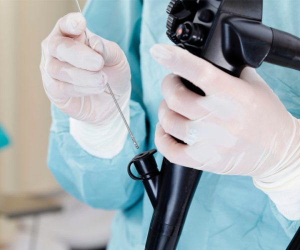 Endoscopic Ultrasound (EUS)