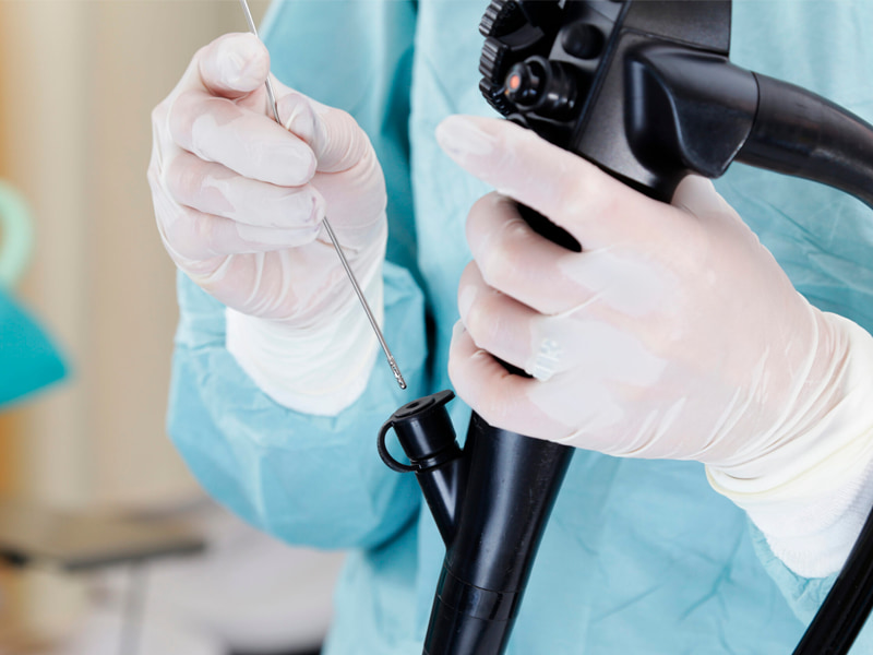 Endoscopic ultrasound (eus)