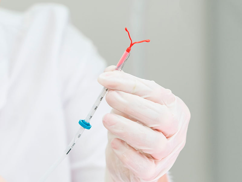 Iud insertion and removal 10 Iud-insertion-and-removal