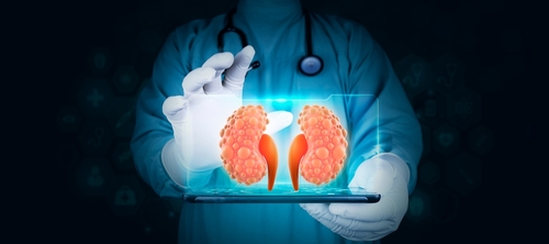 How to prevent kidney cysts: 5 expert-backed habits for healthier kidneys 1 Kidney cysts