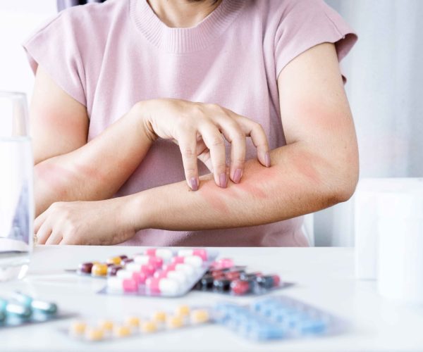 Medication-Allergies Medication-Allergies