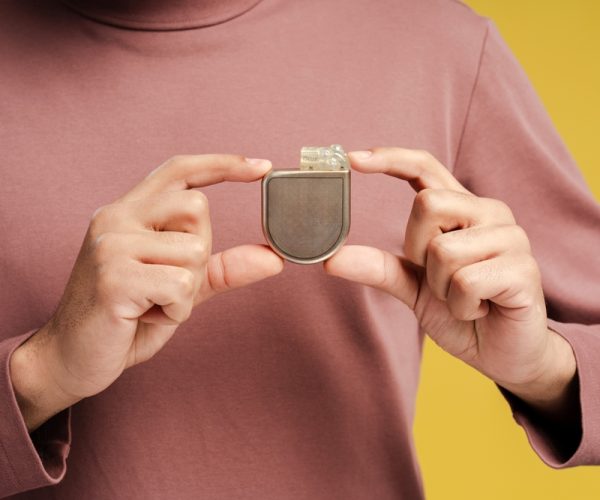 Pacemaker Implantation 