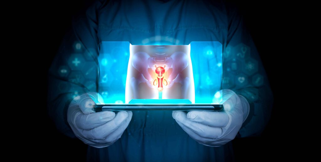 Peyronie’s disease 7 Peyronieocos disease