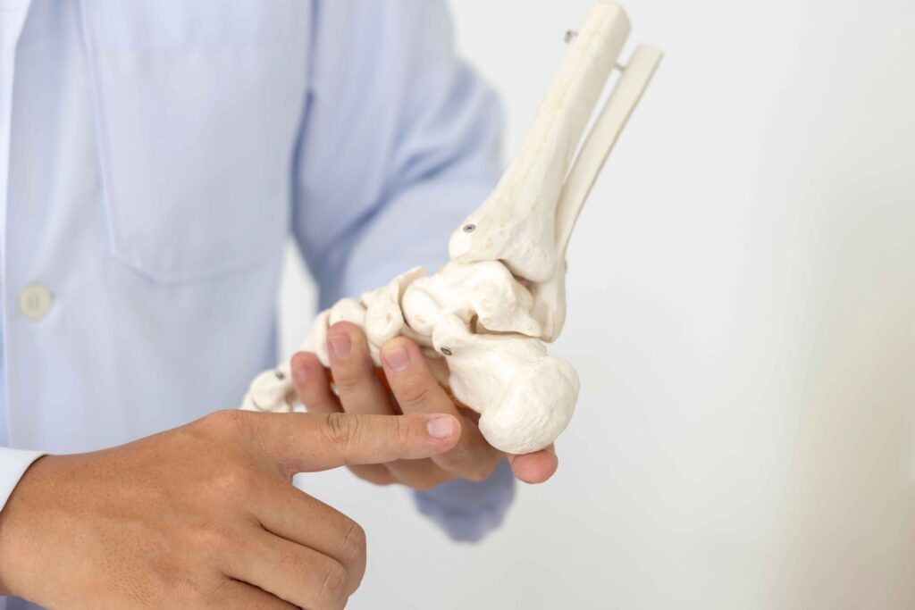 Plantar fasciitis surgery