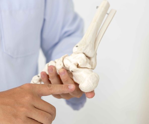 Plantar Fasciitis Surgery