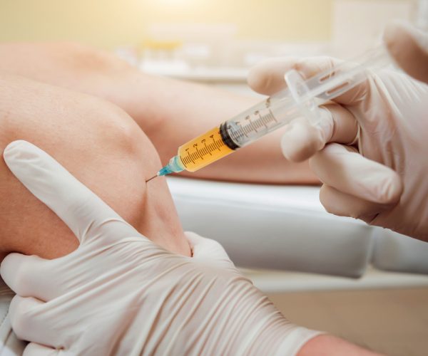 Platelet-rich,Plasma,Injection,Of,The,Knee