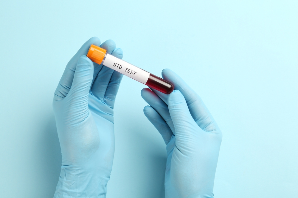 Common stds and rapid std testing: understanding your options 1 Rapid std testing