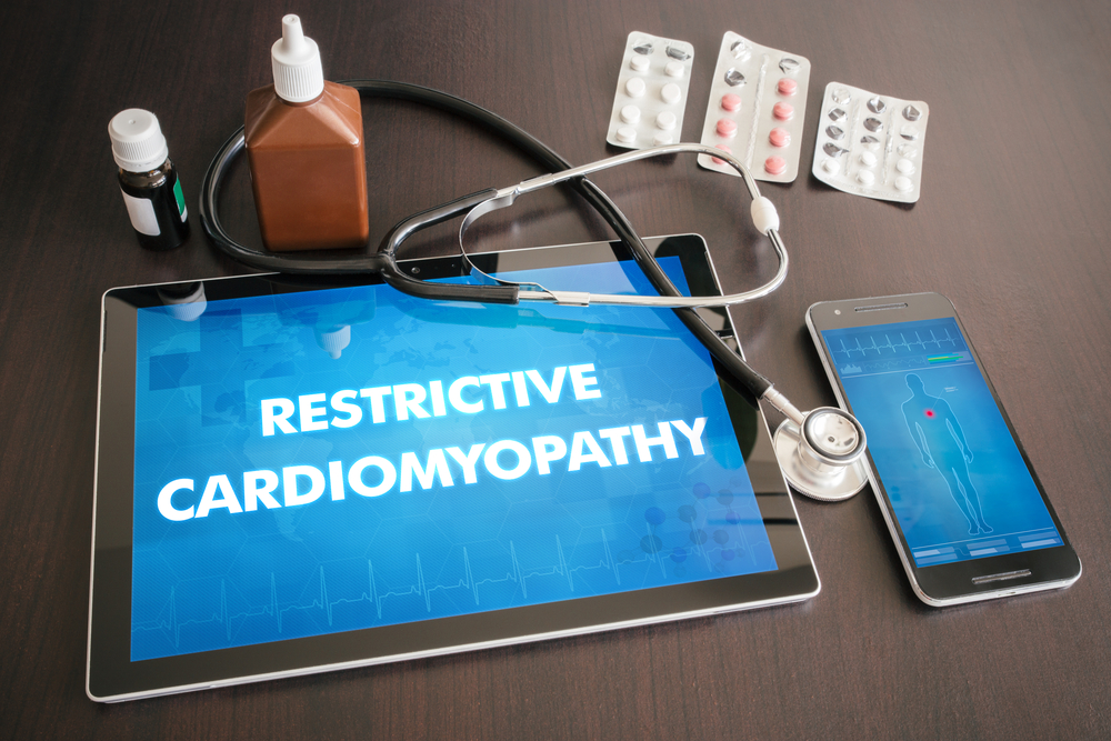 What is restrictive cardiomyopathy 1 Restrictive cardiomyopathy