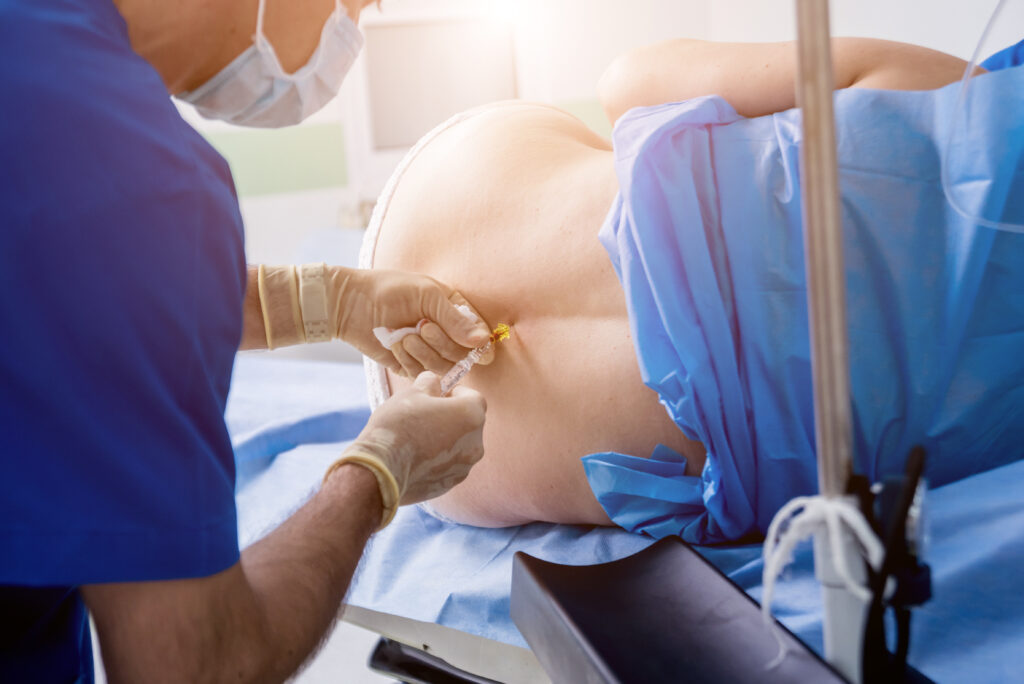 Epidural injections