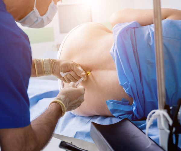 Epidural Injections