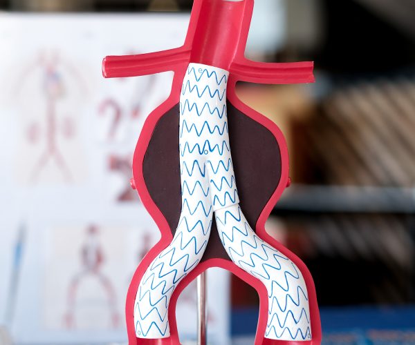 Endovascular Aneurysm Repair (EVAR) Endovascular Aneurysm Repair (EVAR)