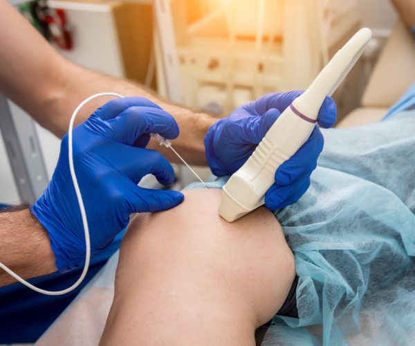 Cardiologist,Use,Tubes,And,Ultrasound,For,Radiofrequency,Catheter,Ablation.