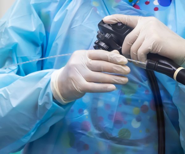 Endoscopic Retrograde Cholangiopancreatography (ERCP)