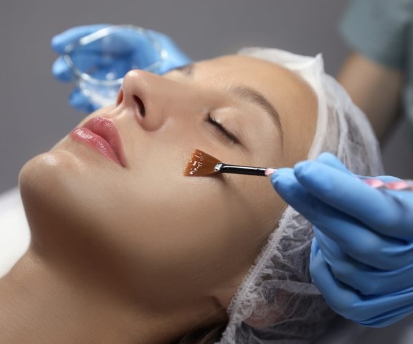Chemical Peels Chemical Peels