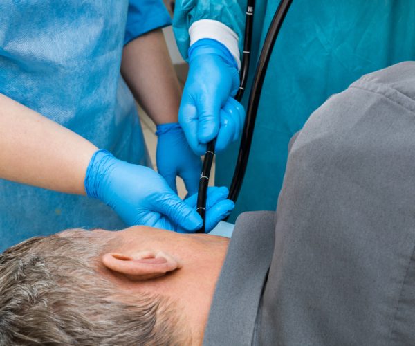 Esophagogastroduodenoscopy (EGD) Esophagogastroduodenoscopy (EGD)