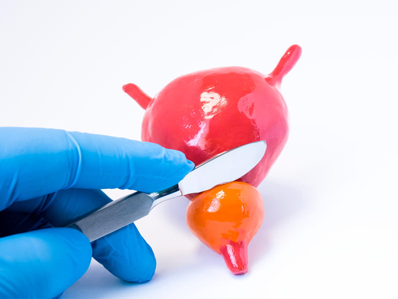 Transurethral resection of the prostate