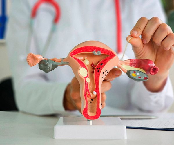 Tubal Ligation Tubal-Ligation