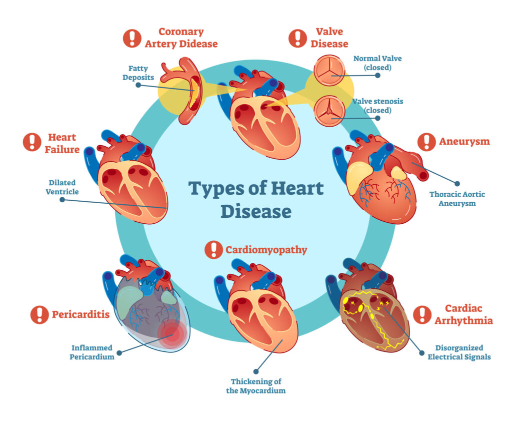 Types of heart disease and their symptoms 1 Types of heart disease