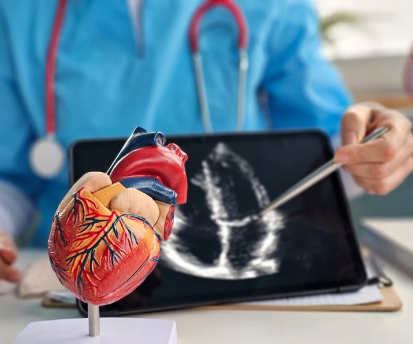 Vascular Study Vascular Study