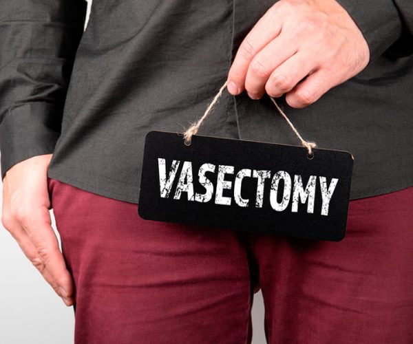 Vasectomy