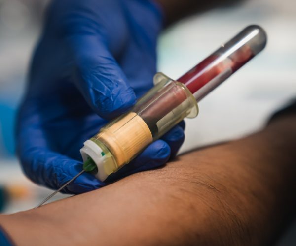 Routine Venipuncture