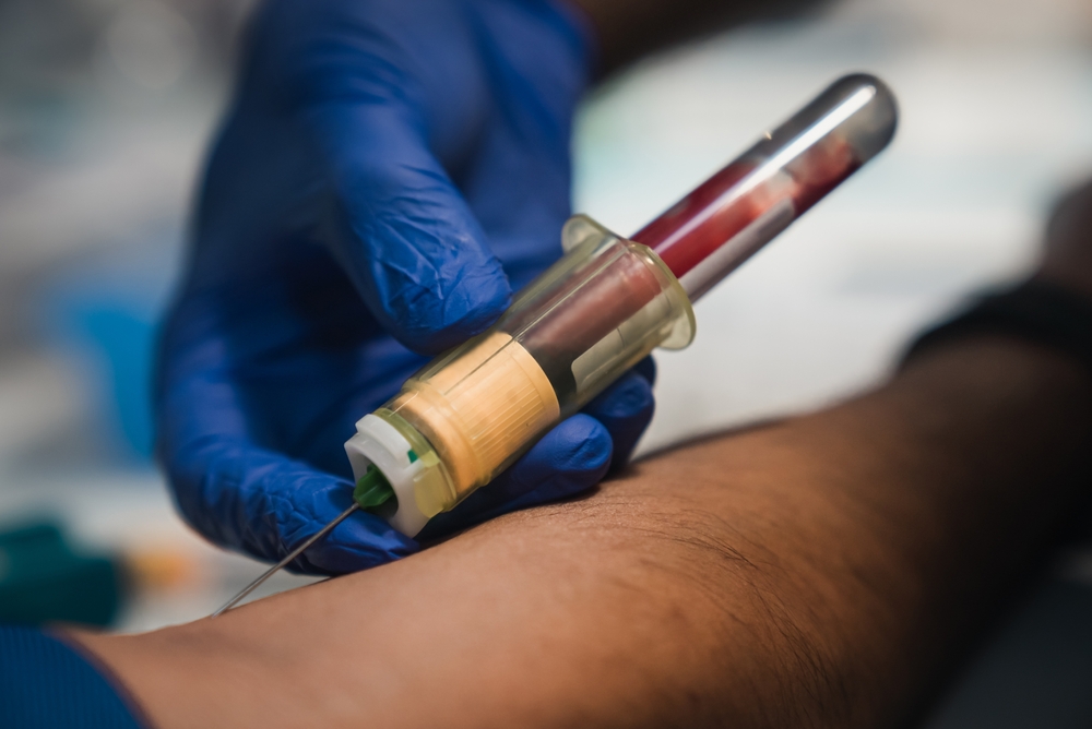 Routine venipuncture