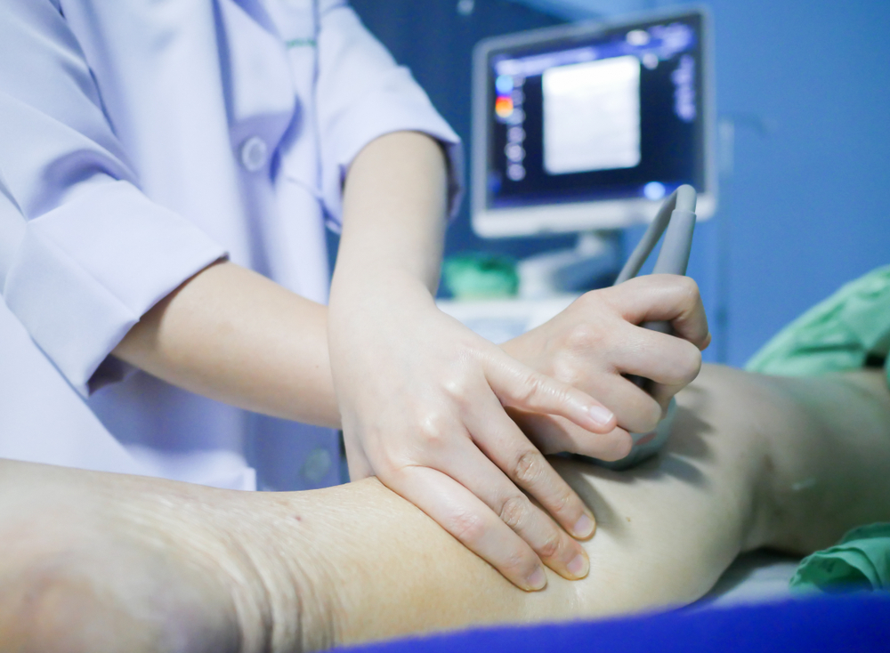 venous ultrasound, signs you need a venous ultrasound