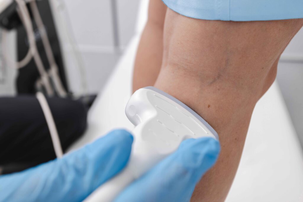 Venous/vascular ultrasound (lower extremity)