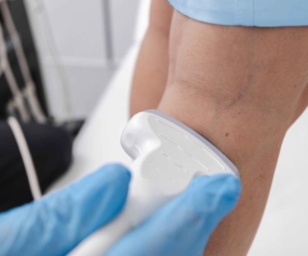 Venous/Vascular Ultrasound (Lower Extremity)
